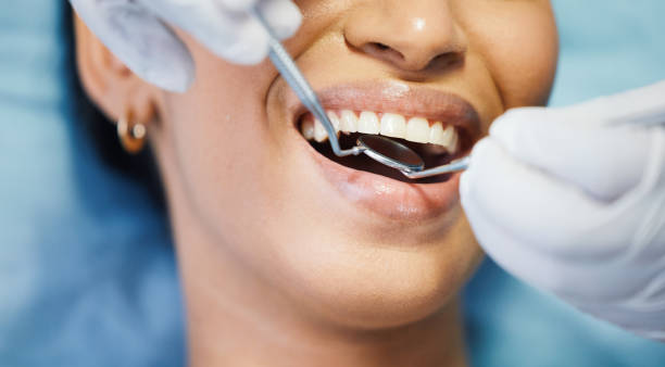 Best Emergency Wisdom Teeth Removal in Cozad, NE